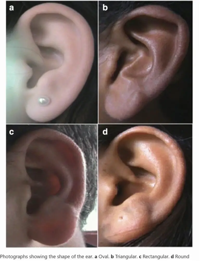 Why Headphones Cause Ear Pain & Best Relief Tips